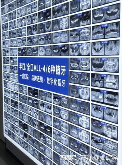 数字化赋能口腔诊疗晋江贝成口腔以先进设备引领行业升级(图3)